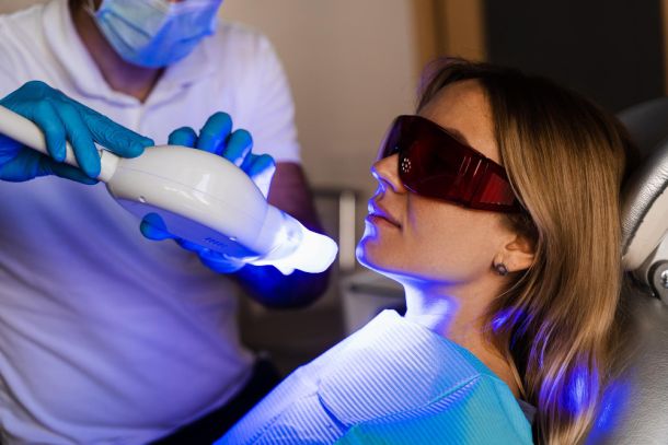 woman in a dentist chair having teeth whitening treatment