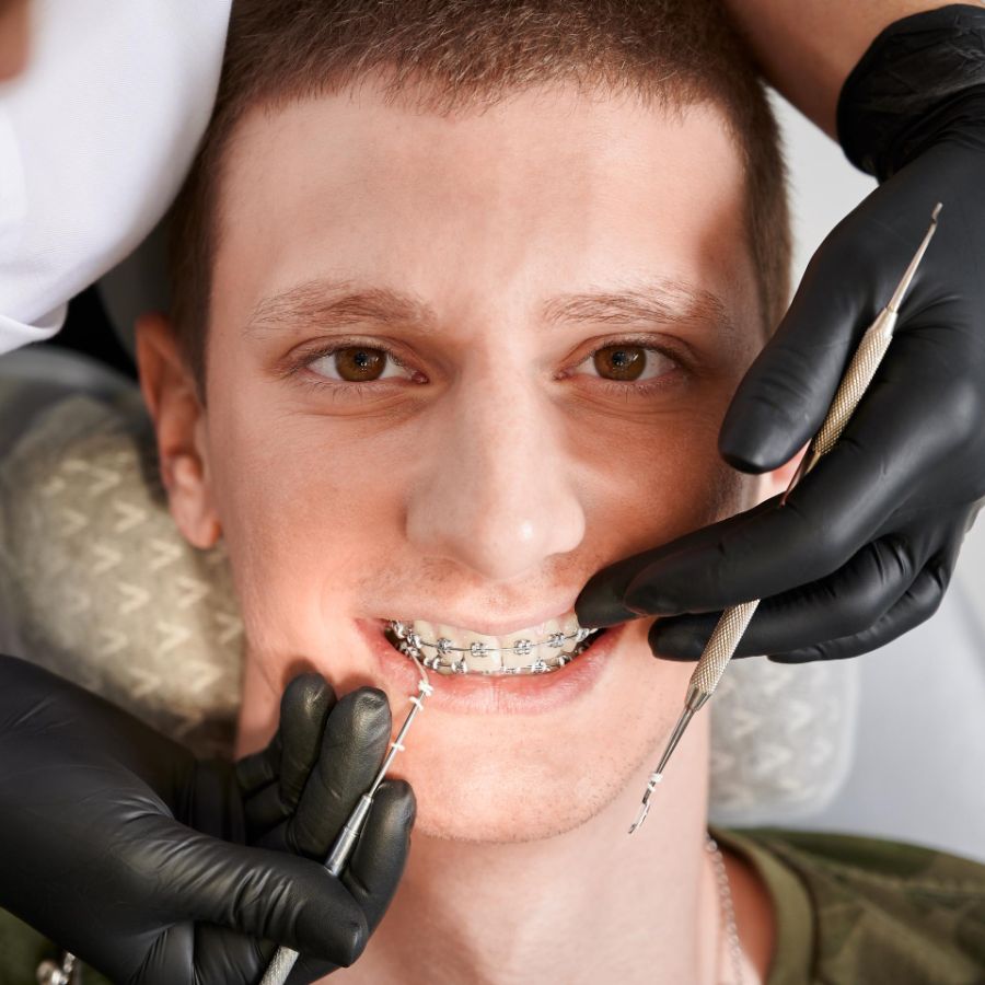 Closeup snapshot of a man's face and dentist's hands putting on rubber bands on brackets